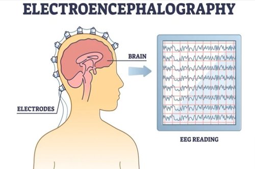 EEG (Electroencephalography)Explain Brains Treatment