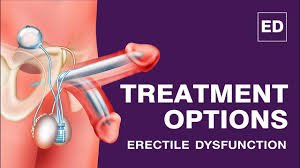 Best ED Treatment In Bhandara