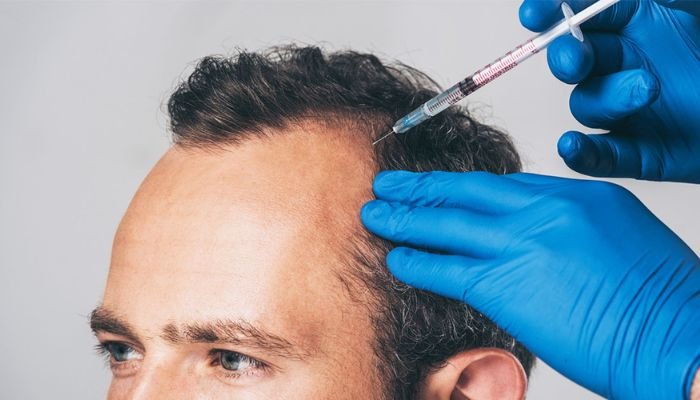 Best PRP Therapy for Men in Nagpur
