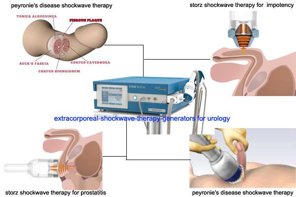 Erectile Dysfunction Shockwave Treatment in Katni