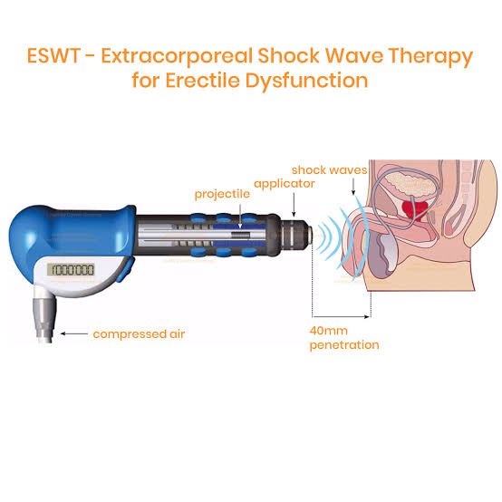 Erectile Dysfunction Shockwave Treatment in Satna