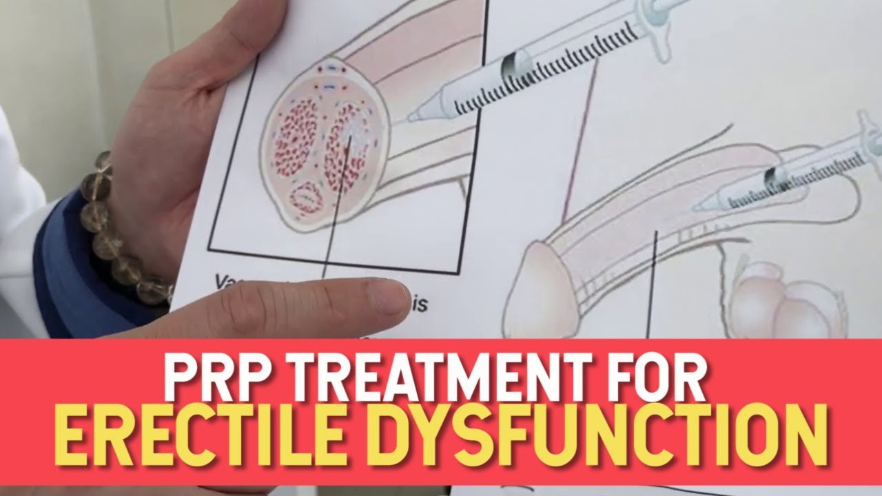 Erectile dysfunction for prp therapy in jabalpur