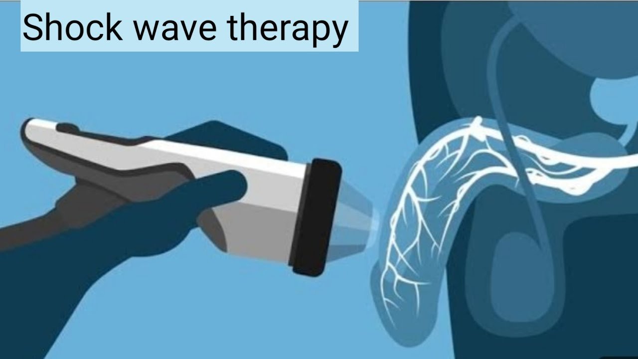 Erectile dysfunction shockwave therapy in jabalpur