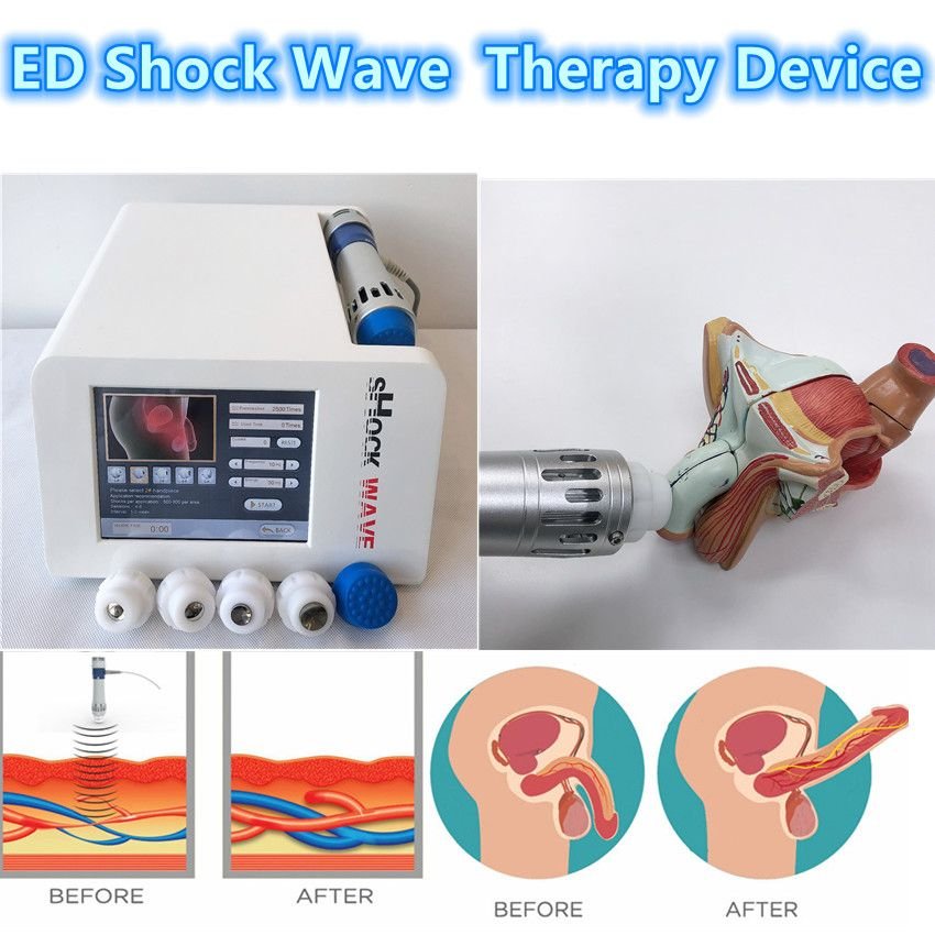Low intensity shockwave therapy in rewa