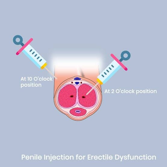 P Shot Treatment in Amravati