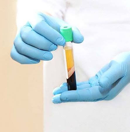 PRP Treatment for ED In Satna