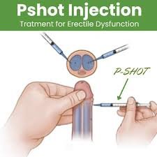 Best P Shot Clinic In Bhopal