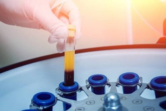 Best PRP Therapy for Men in Gadchiroli