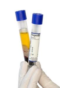 Best PRP Therapy for Men in Harda