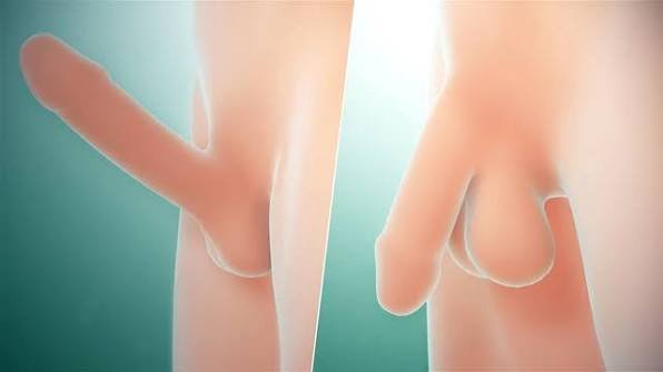 Erectile Dysfunction Doctor Yavatmal
