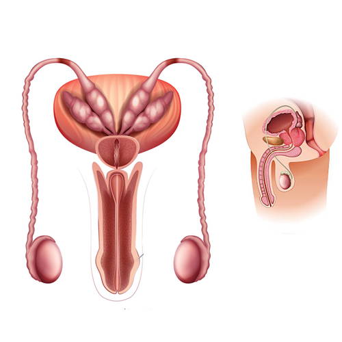 Erectile Dysfunction PRP Therapy in Mandla