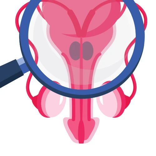 Erectile Dysfunction PRP Therapy in Sagar