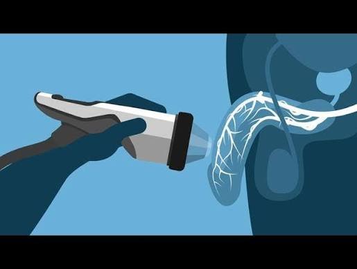Erectile Dysfunction Shockwave Treatment in Gadarwara