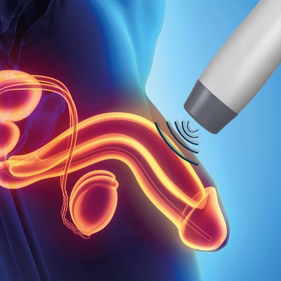 Erectile Dysfunction Shockwave Treatment in Sagar