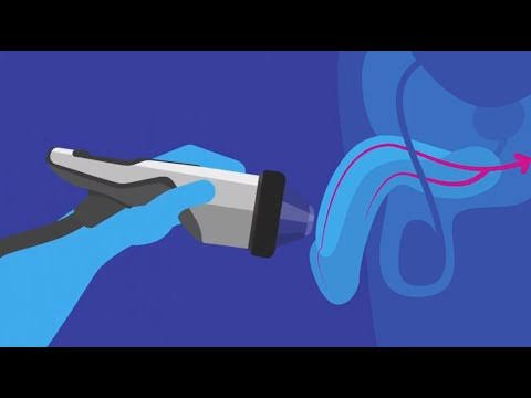 Erectile Dysfunction Shockwave Treatment in Yavatmal