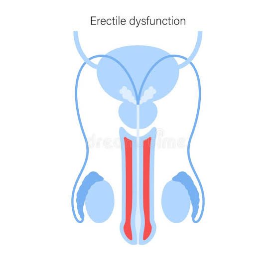 Non Surgical Erectile Dysfunction Treatment in Bhopal