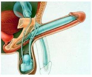 Non Surgical Erectile Dysfunction Treatment in Gadarwara