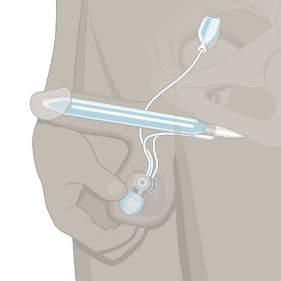 Non Surgical Erectile Dysfunction Treatment in Yavatmal