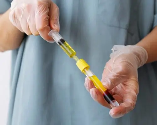 P shot therapy in chhindwara