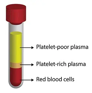 PRP Treatment for ED In Bhopal