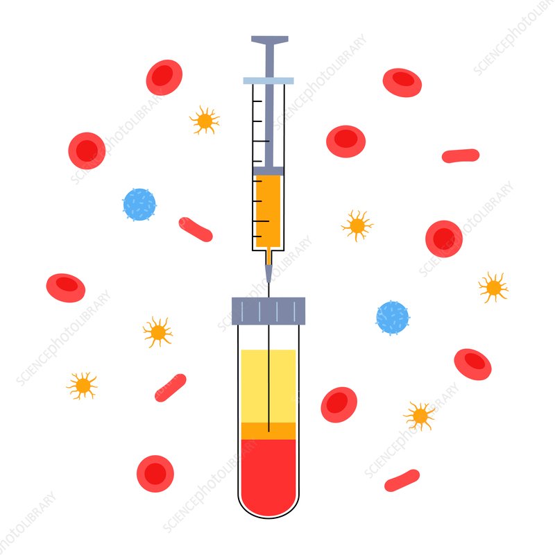 PRP Treatment for ED In Harda