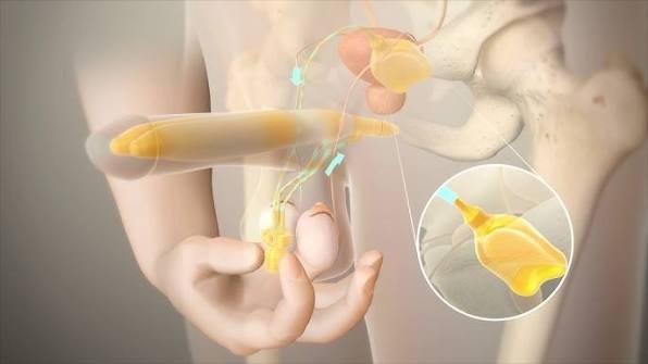 Penis PRP Therapy In Gadchiroli