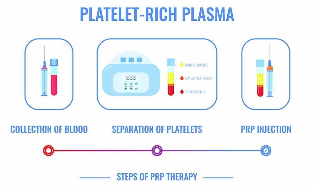 Penis PRP Therapy In Itarsi